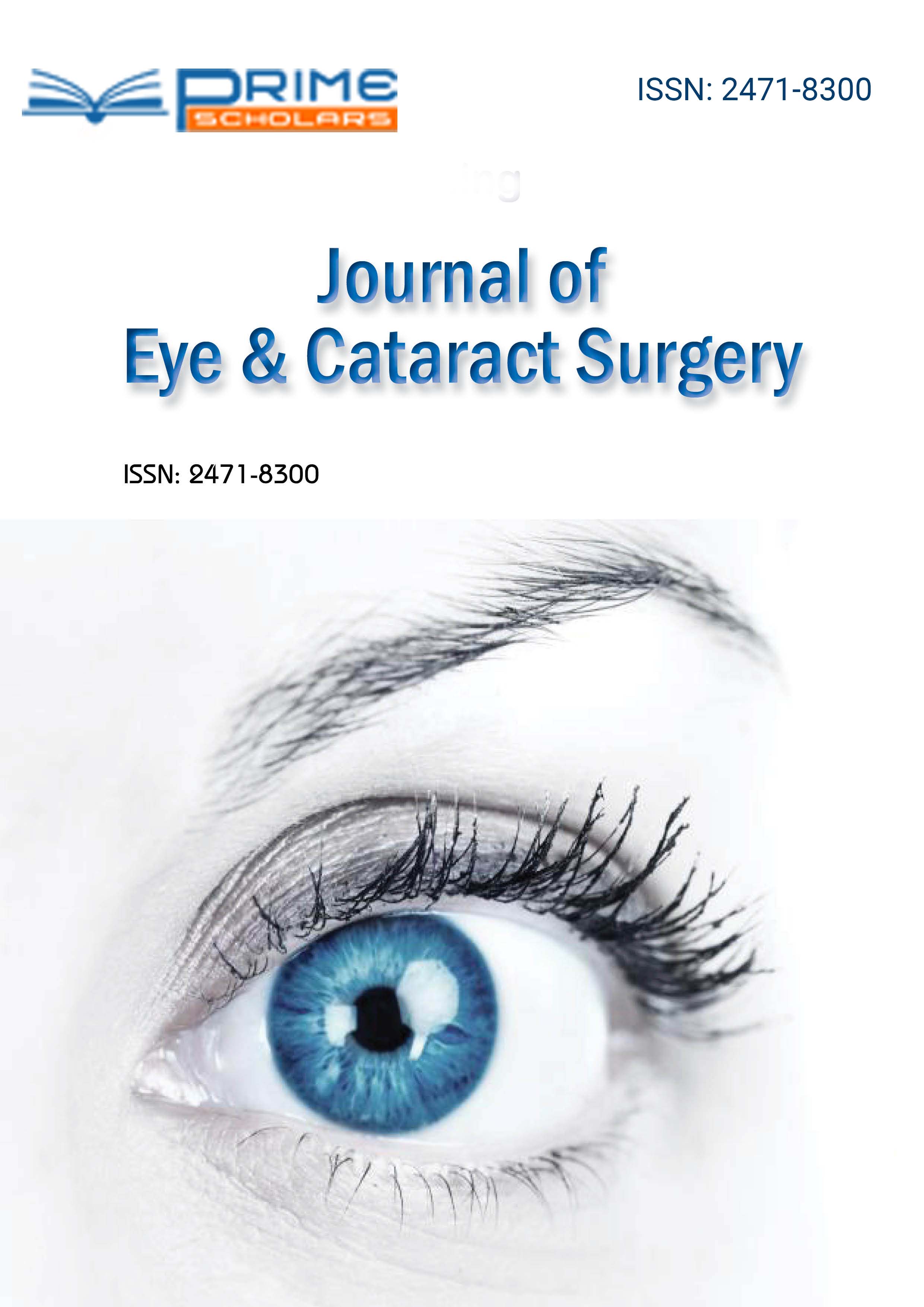 eye--cataract-refractive-surgery-flyer.jpg