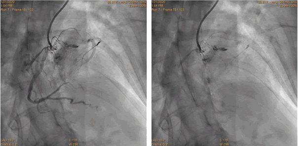 Interventional-Cardiology-Journal-65