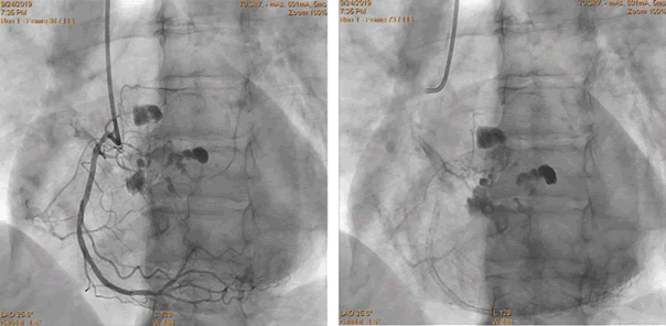 Interventional-Cardiology-Journal-71