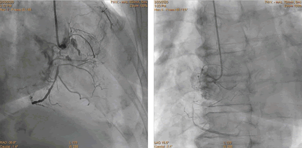 Interventional-Cardiology-Journal-81