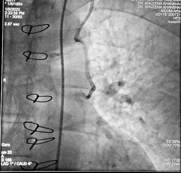 Interventional-Cardiology-Journal-Angiography
