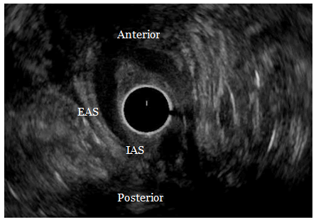 Journal-Clinical-Gastroenterology-Hepatology-Endoanal