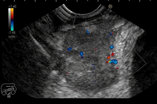 Journal-Clinical-Gastroenterology-Hepatology-Heterogeneous