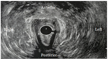 Journal-Clinical-Gastroenterology-Hepatology-Ultrasound