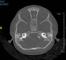 Periodontics-Prosthodontics-CT