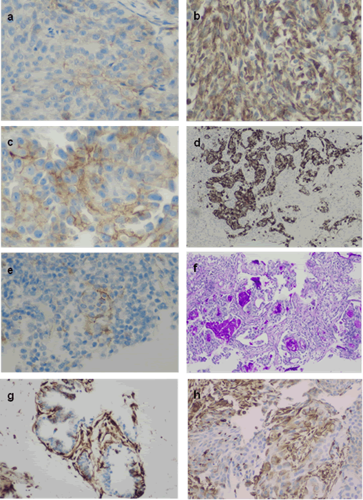 Research-Journal-Oncology-PD