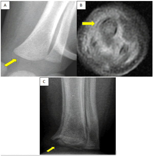 Trauma-Acute-Care-Male