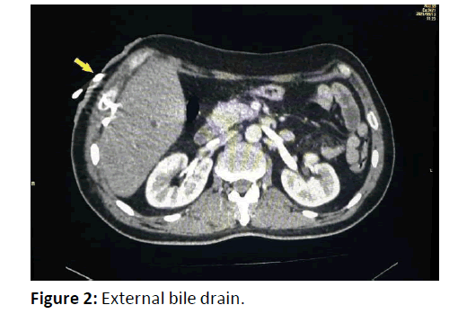 gastroenterology-hepatology-bile