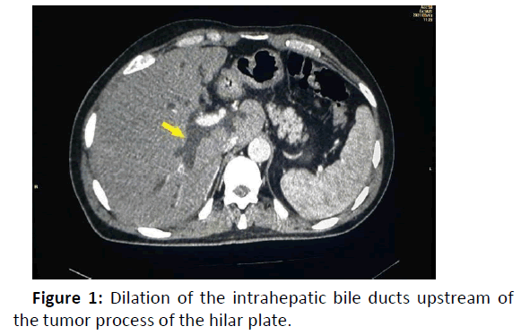 gastroenterology-hepatology-intrahepatic