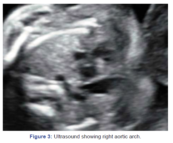gynaecology-obstetrics-aortic-arch
