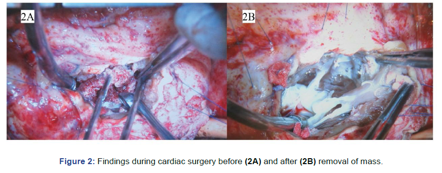 gynaecology-obstetrics-cardiac-surgery