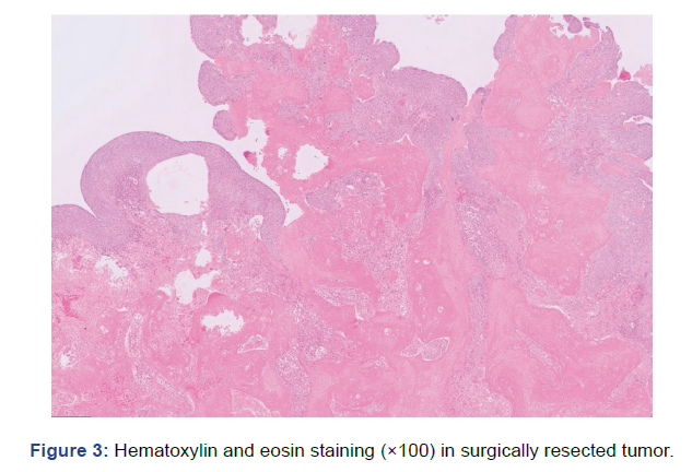 gynaecology-obstetrics-eosin-staining