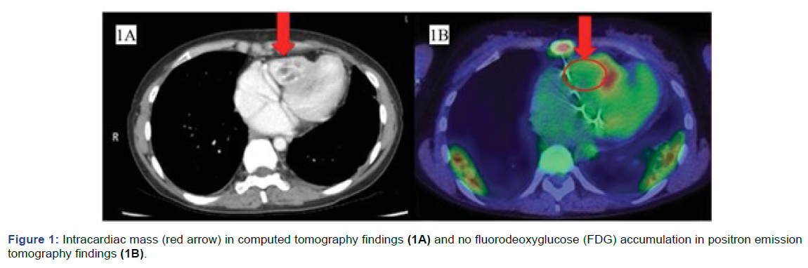 gynaecology-obstetrics-tomography-findings