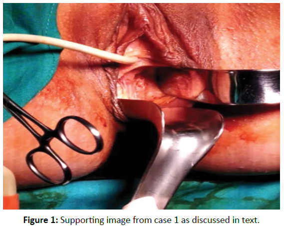 gynecology-obstetrics-case-report-text