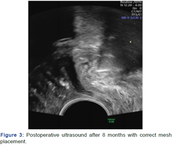 gynecology-obstetrics-case-report-ultrasound