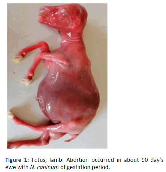 IPBMBJ-Fetus