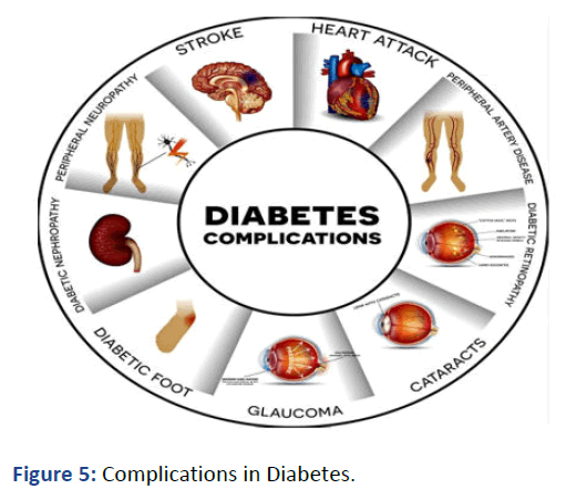 IPJDRE-Diabetes