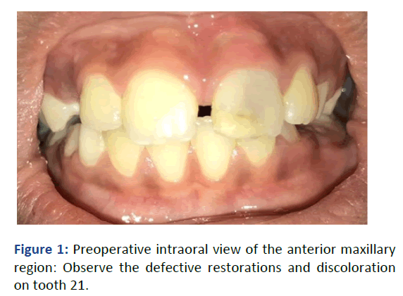 IPPDPD-Preop