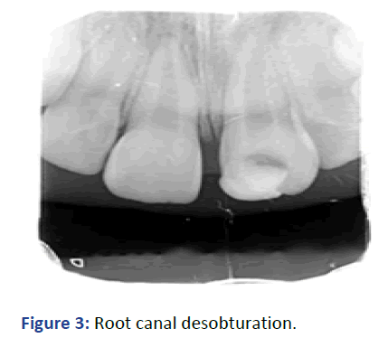 IPPDPD-Root