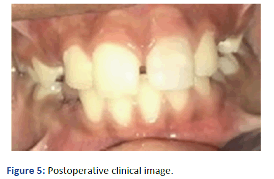 IPPDPD-clinical