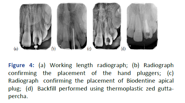 IPPDPD-length