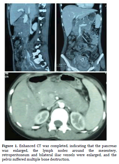 Pancreas-Enhanced