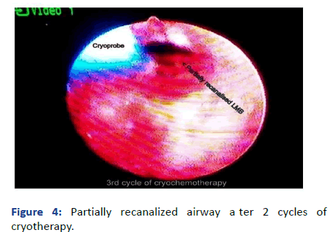 aasrfc-Partially