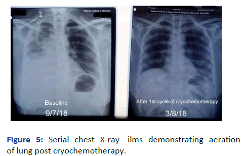 aasrfc-Serial