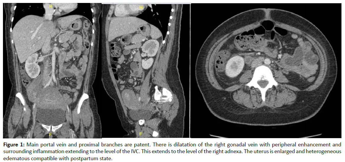 gynecology-obstetrics-case-report-edematous