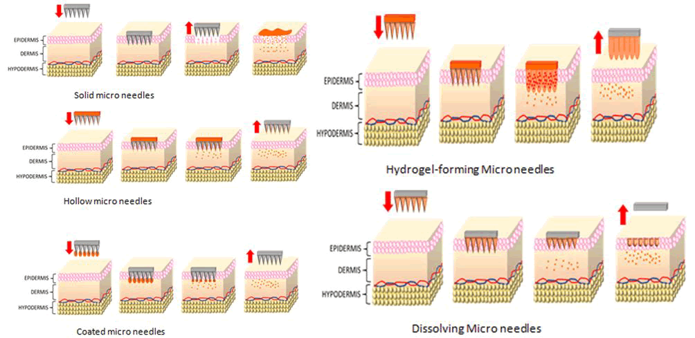 ipipr-Classification