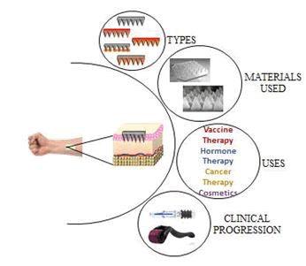 ipipr-Types