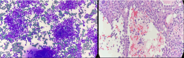 journal-oncology-Histopathology