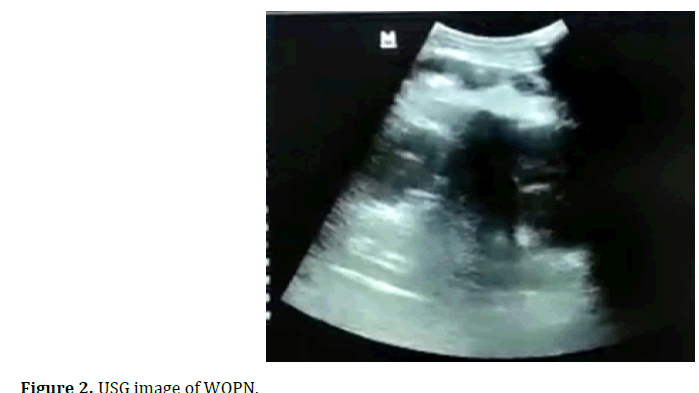 pancreas