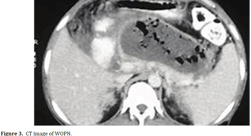 pancreas