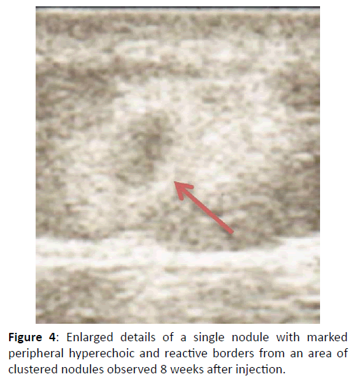 Diversity-Health-Care-Enlarged-details-single-nodule