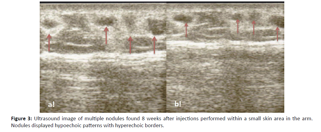 Diversity-Health-Care-Ultrasound-image-multiple-nodules-site