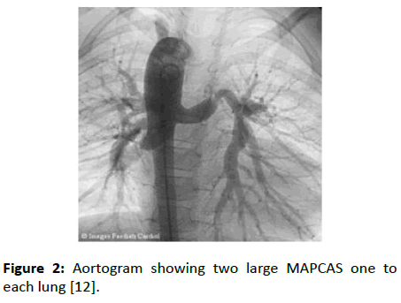 Experimental-Biology-Aortogram