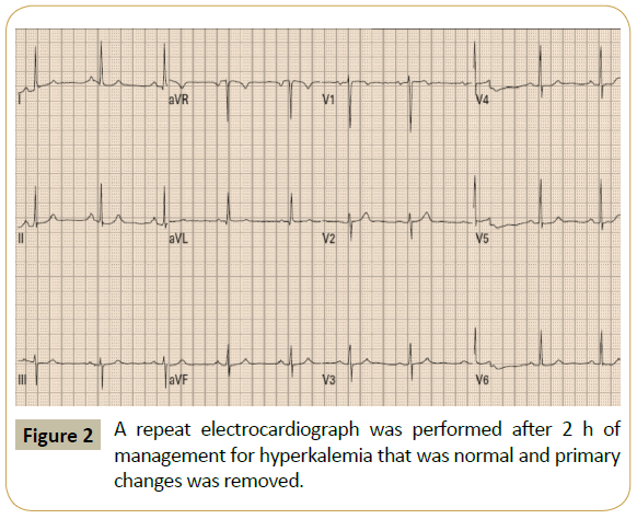 Intensive-Critical-Care-A-repeat-electrocardiograph-performed