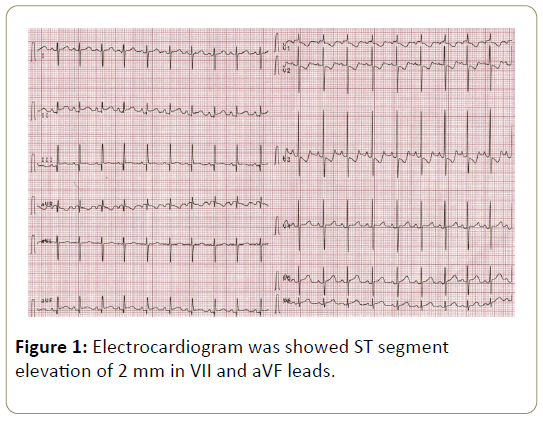 Intensive-Critical-Care-Electrocardiogram