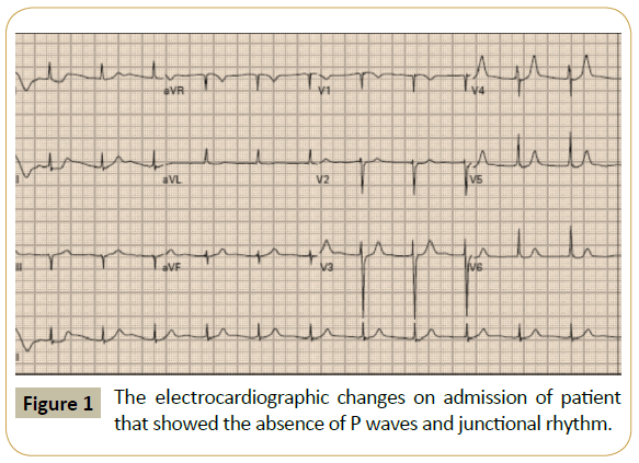 Intensive-Critical-Care-The-electrocardiographic-changes-admission