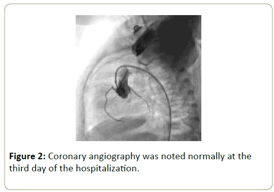 Intensive-Critical-Care-angiography