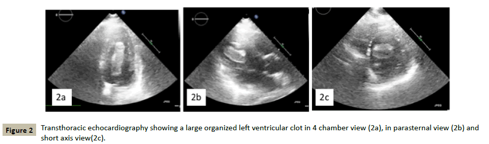 Interventional-Transthoracic-echocardiography