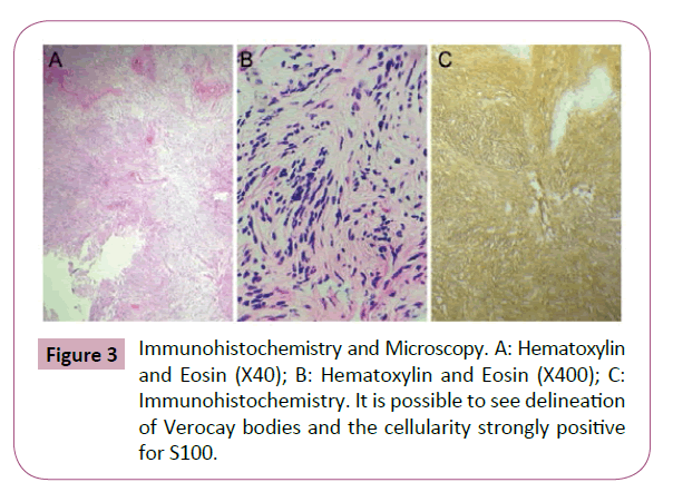 Neuro-Oncology-Immunohistochemistry-Microscopy-Hematoxylin-Eosin