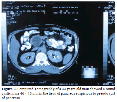 Pancreas-Computed-Tomography-33-years-old-man