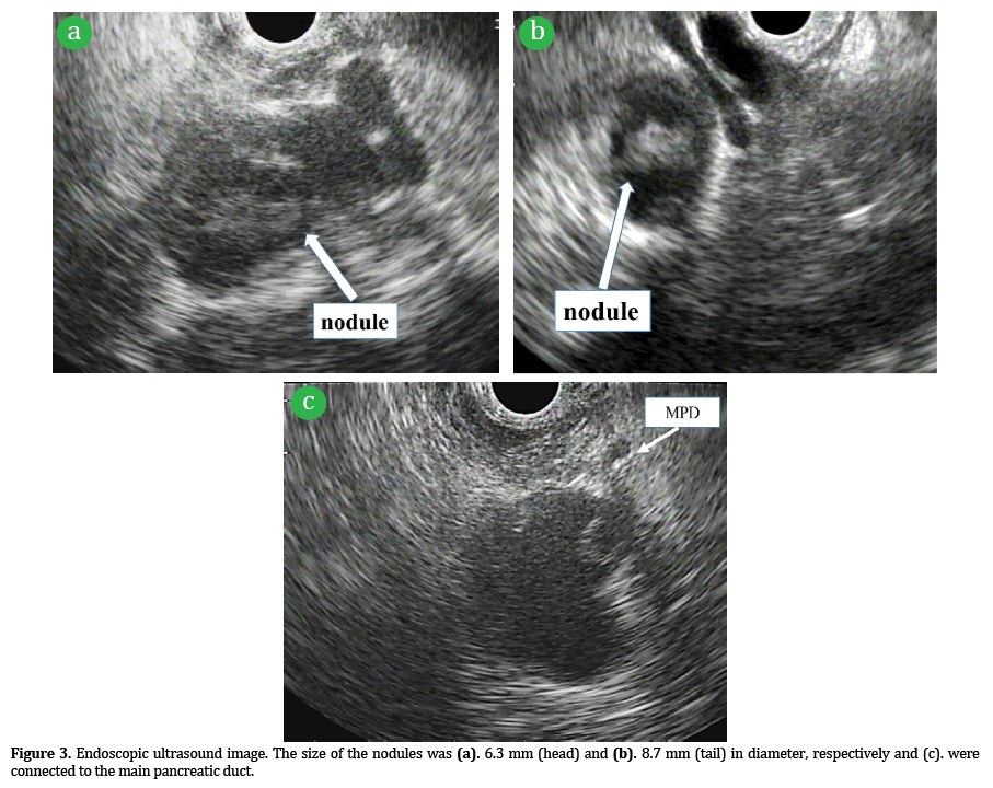 Pancreas-Endoscopic-ultrasound-image