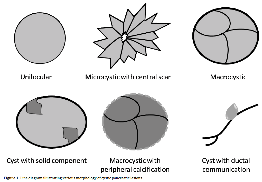 Pancreas-Line-diagram-illustrating-various