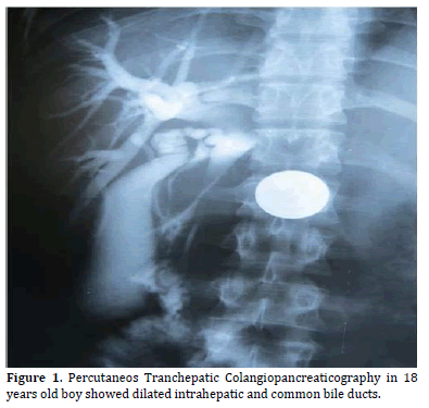 Pancreas-Percutaneos-Tranchepatic-Colangiopancreaticography