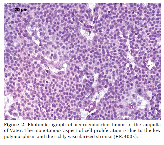 Pancreas-Photomicrograph-neuroendocrine-monotonous-aspect