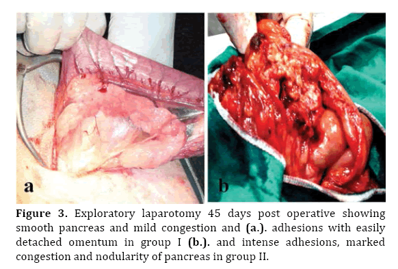 Pancreas-exploratory-laparotomy