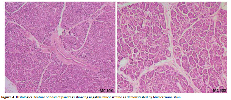 Pancreas-negative-mucicarmine